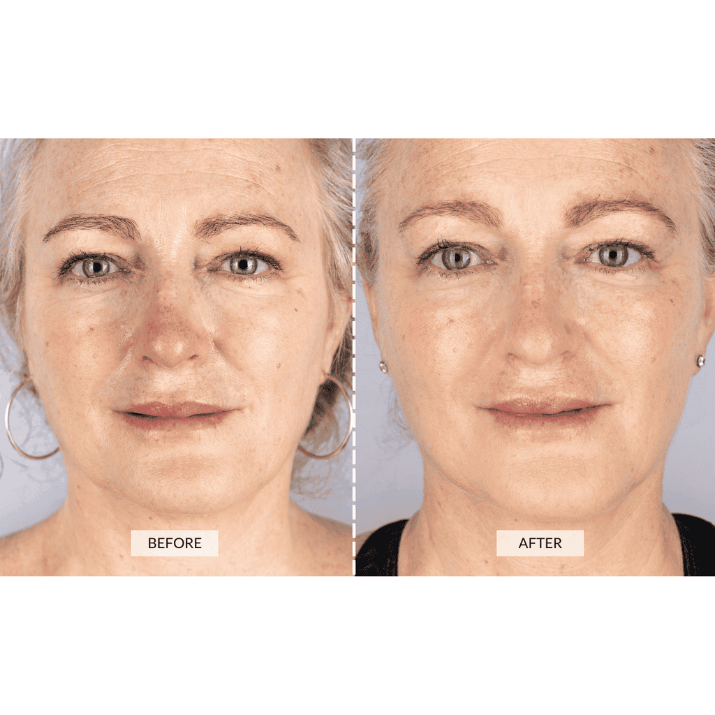 CurrentBody Skin Face & Neck Kit (worth 668€) - Black Friday Offer