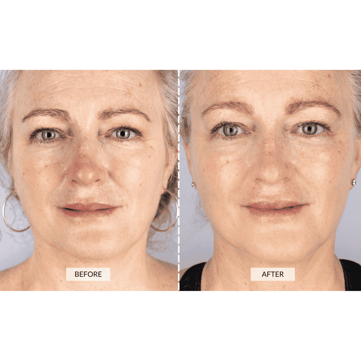 CurrentBody Skin Face & Neck Kit (worth 668€) - Black Friday Offer
