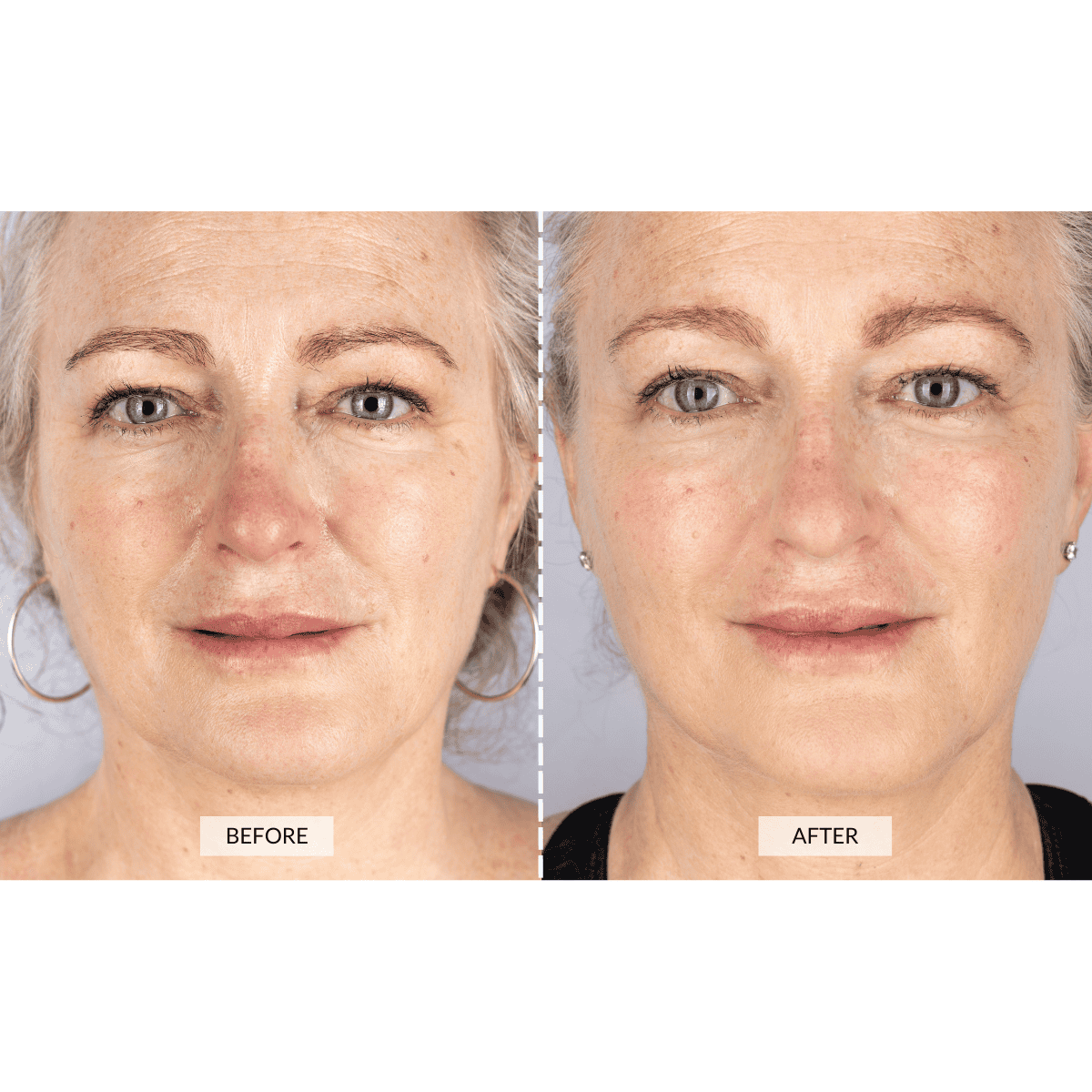 CurrentBody Skin Silver LED Beauty Geschenkset PR