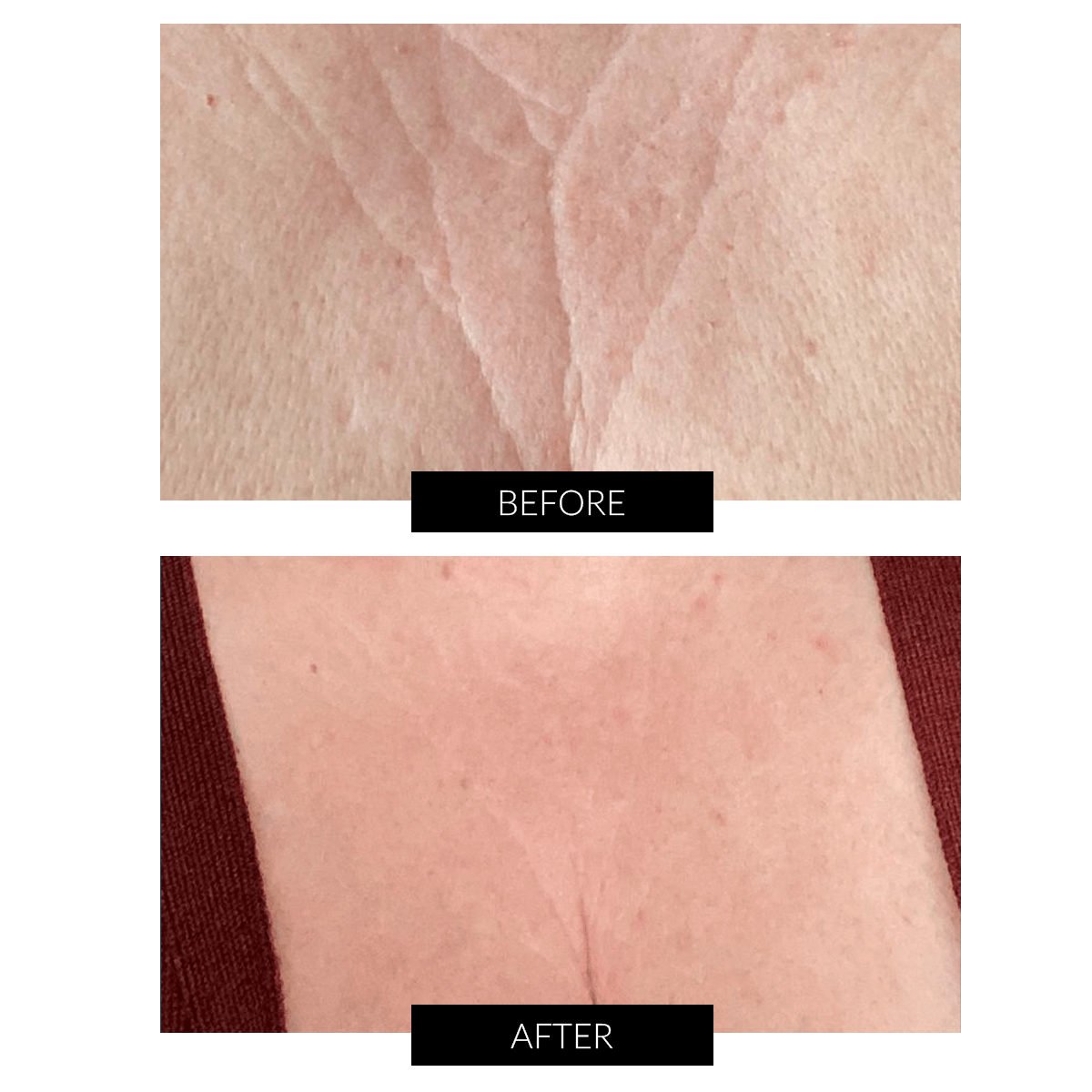 CurrentBody Skin Hals & Dekolleté Perfector Angebot
