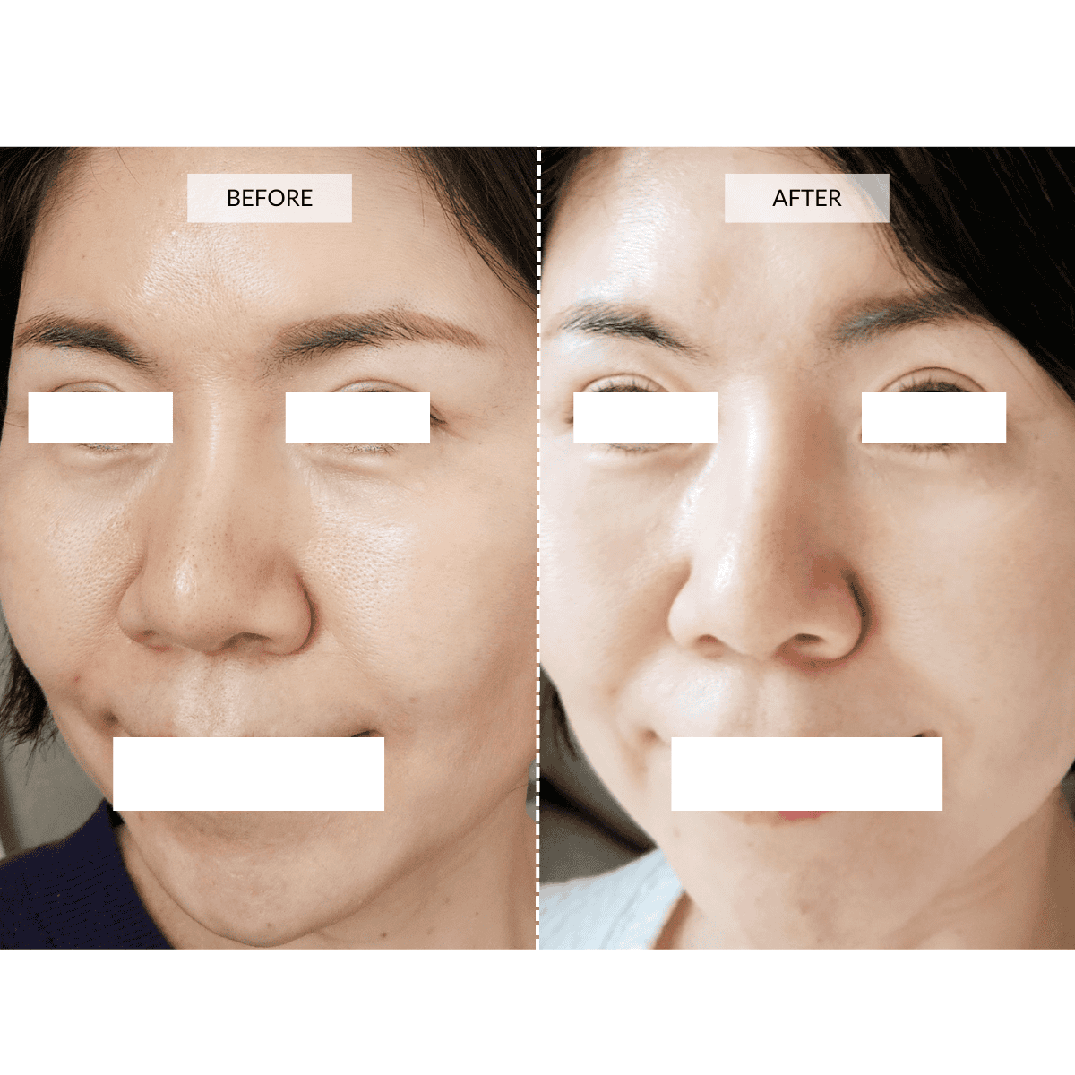 CurrentBody Skin LED 4-in-1 Zonen Mapping Gesichtsmaske in Limitierter Edition