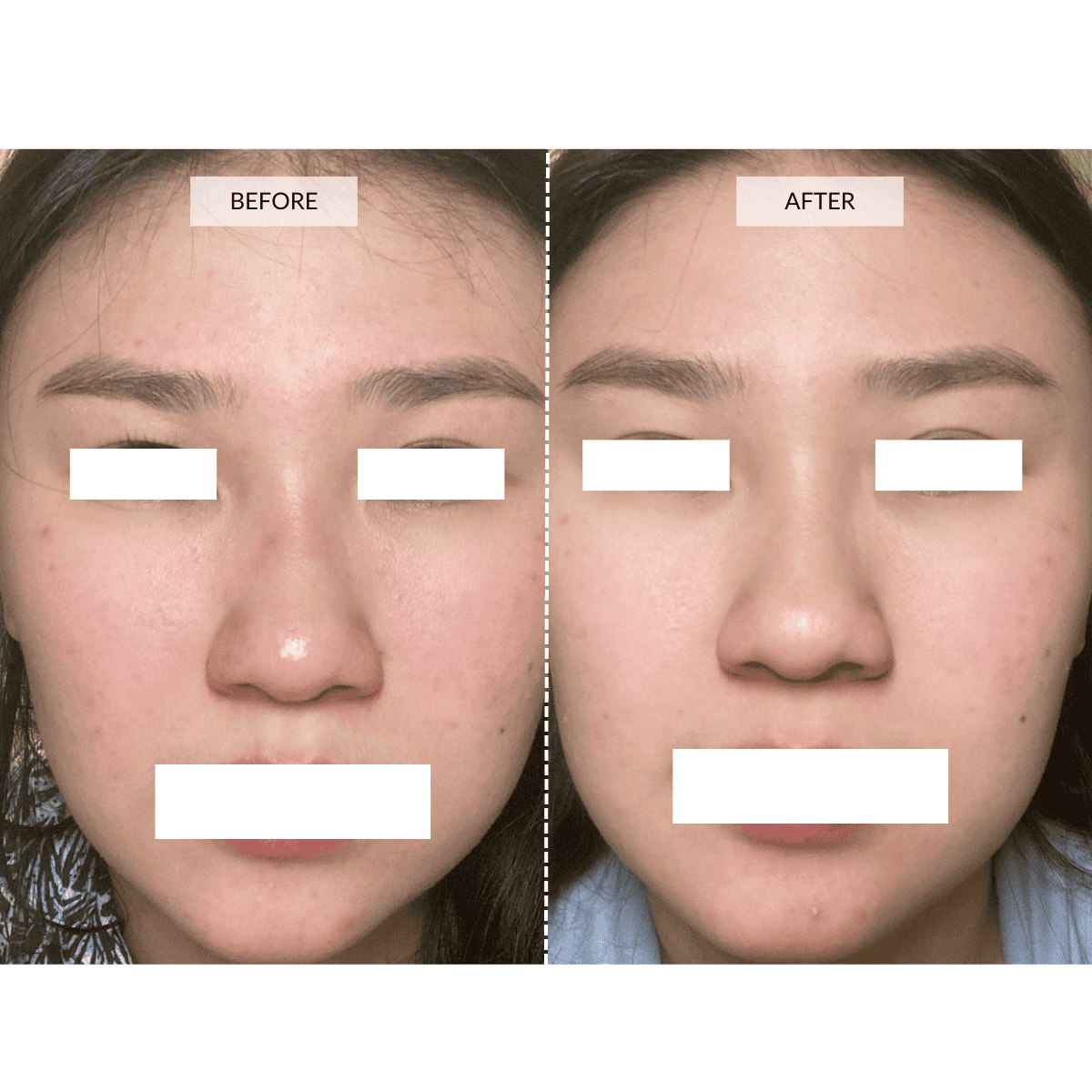 CurrentBody Skin LED 4-in-1 Zonen Mapping Gesichtsmaske in Limitierter Edition