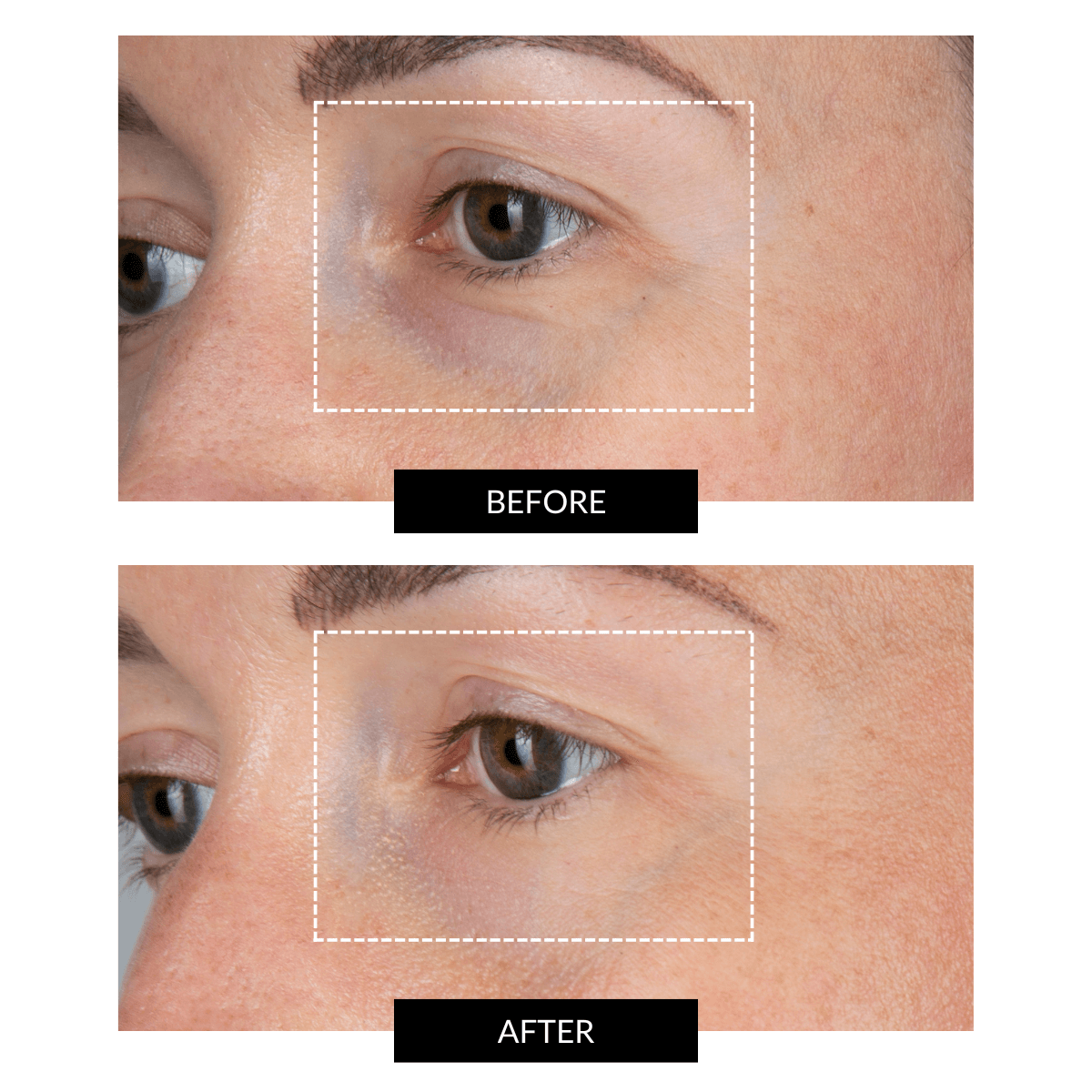CurrentBody Skin LED Eye Perfector & 5 Hydrogel Augen Masken (im Wert von 259 €)