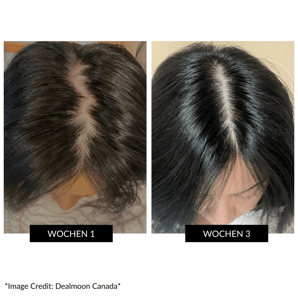 CurrentBody Skin LED Gerät gegen Haarausfall