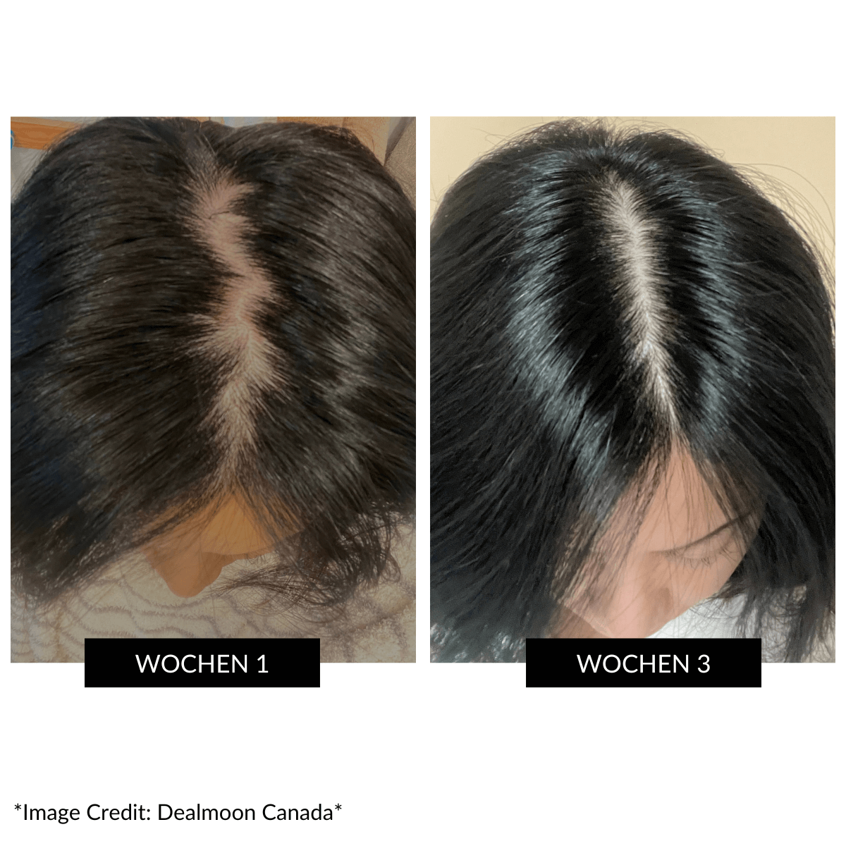CurrentBody Skin LED Gerät gegen Haarausfall Angebot