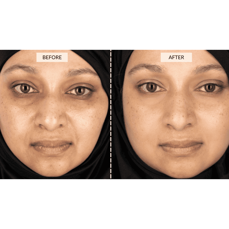 CurrentBody Skin Silver LED Beauty Geschenkset PR