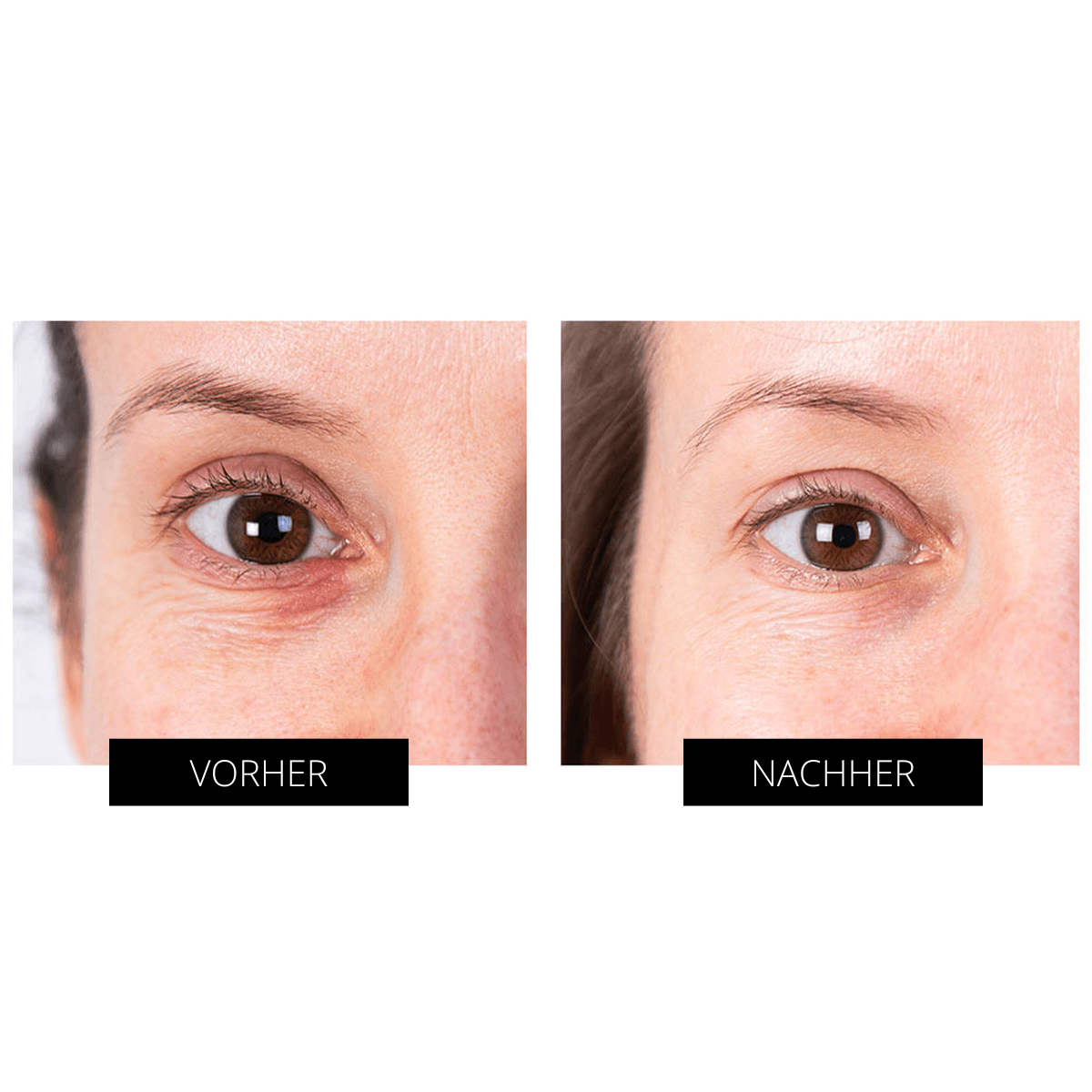 CurrentBody Skin LED Eye Perfector Angebot