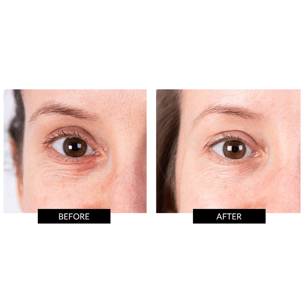 CurrentBody Skin LED Eye Perfector & 5 Hydrogel Augen Masken (im Wert von 259 €)