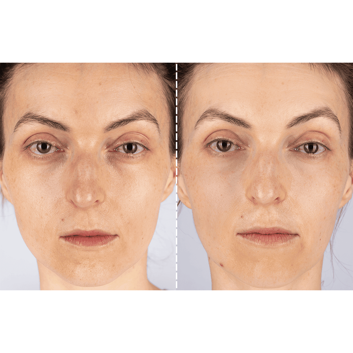 CurrentBody Skin X Peter Rabbit Limited Edition LED Light Therapy Mask