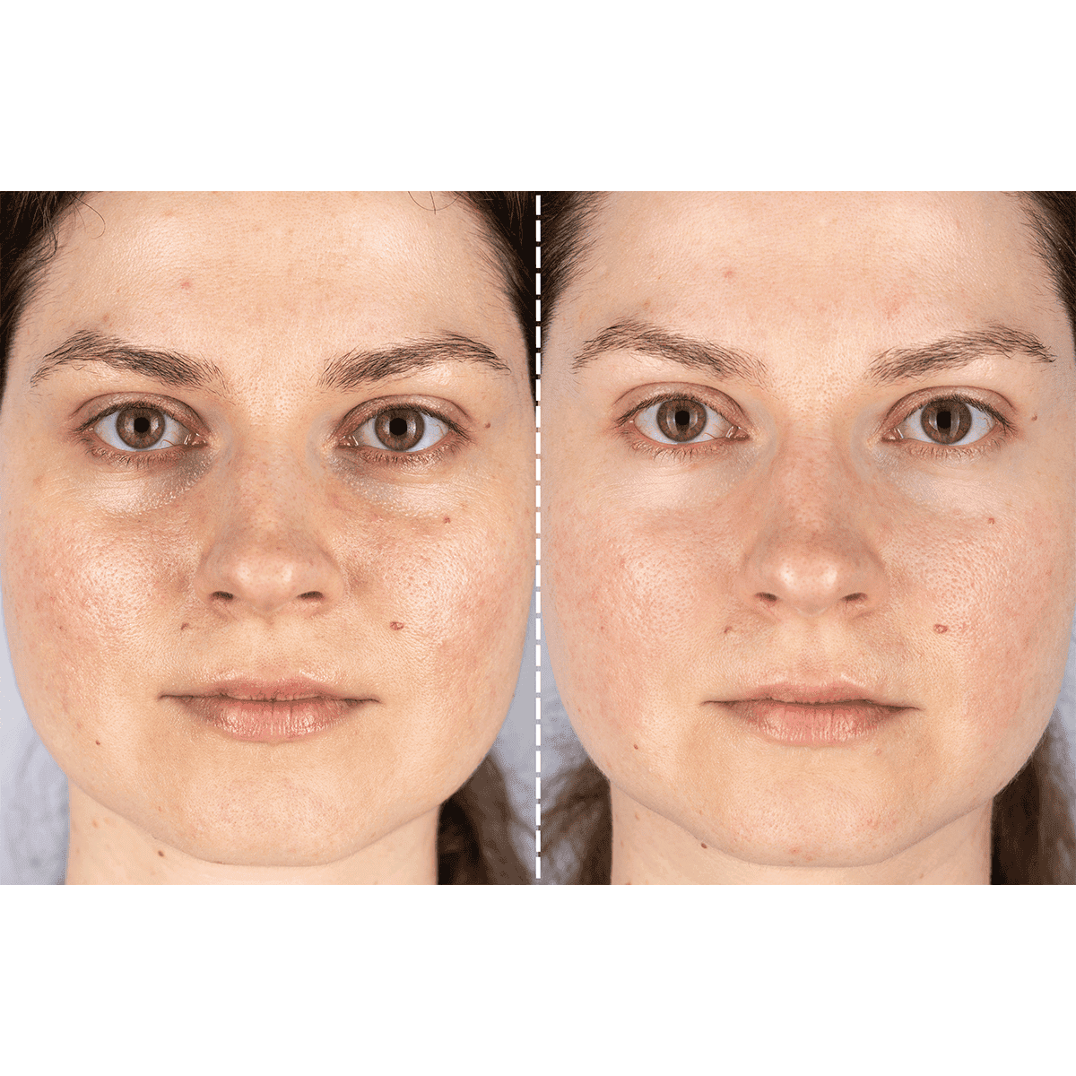 CurrentBody Skin X Peter Rabbit Limited Edition LED Light Therapy Mask